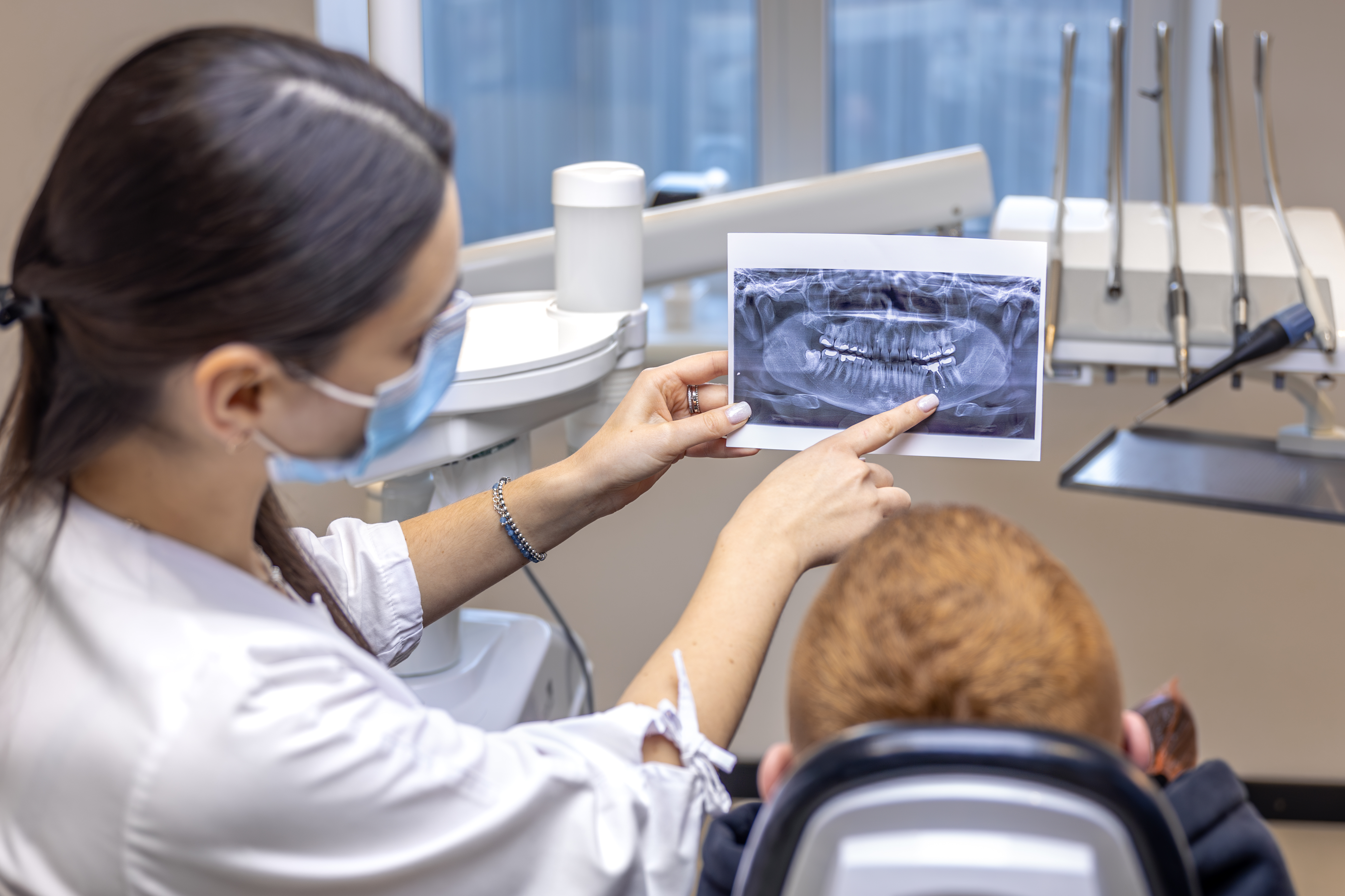 Kada treba snimati zube